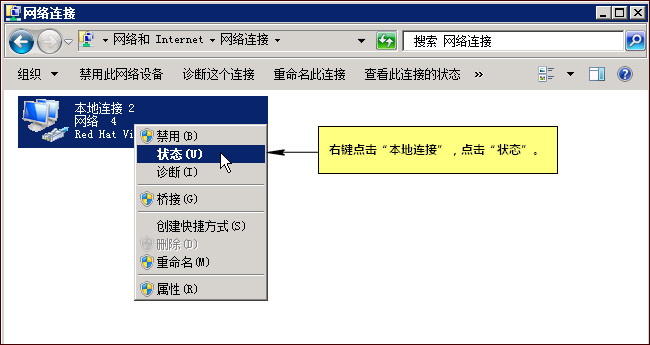 查看本地連接狀態
